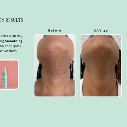 Sweet & True ingrown hair serum benefits diagram for sugaring clients